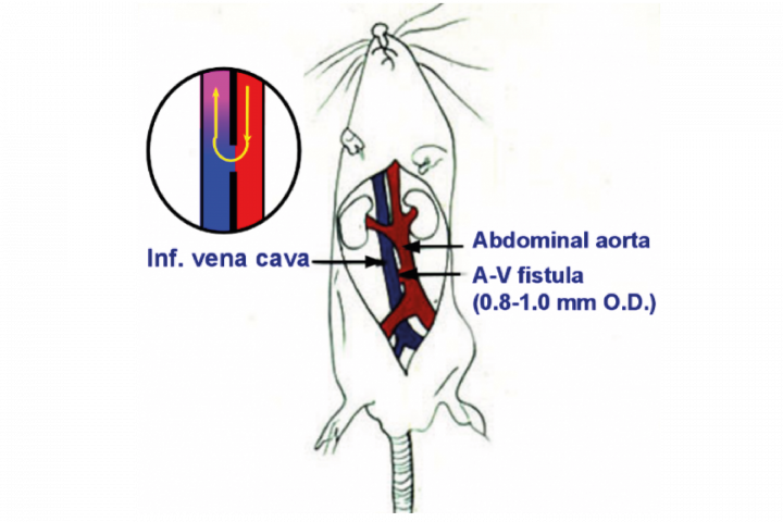 Aorto-Caval Fistula Model